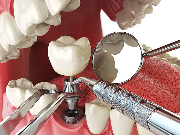 Best Emergency Dentist for Special Needs Patients in Breckenridge, MI